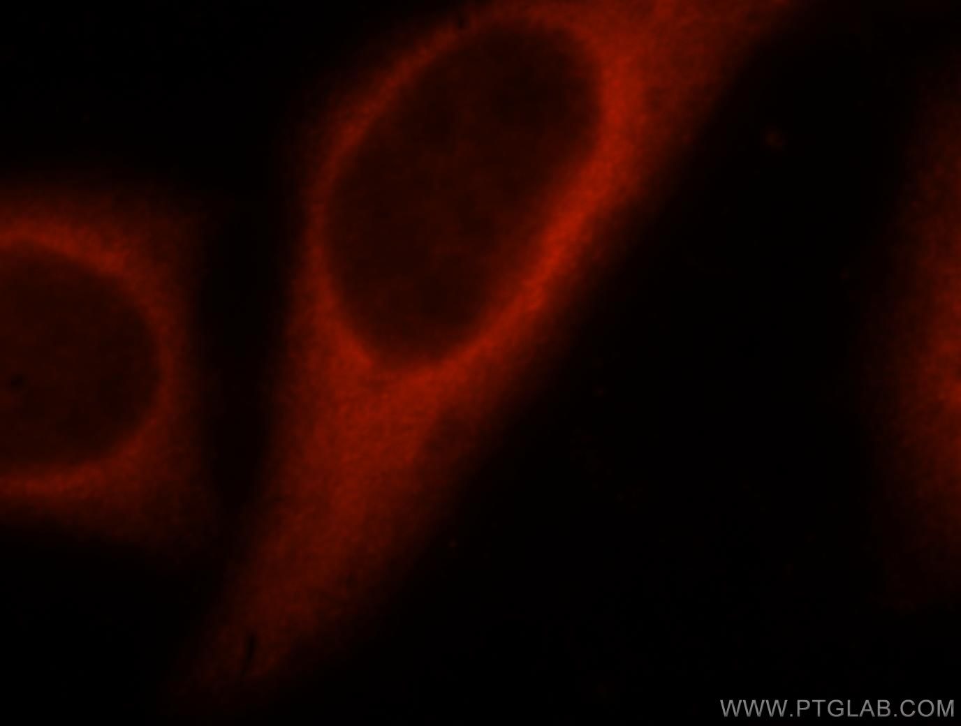 IF Staining of HepG2 using 15421-1-AP