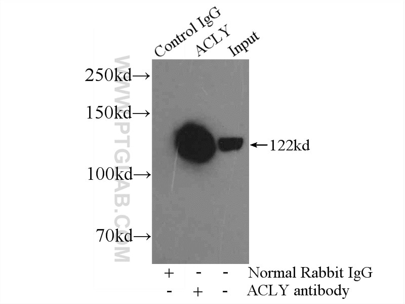 Immunoprecipitation (IP) experiment of K-562 cells using ACLY Polyclonal antibody (15421-1-AP)