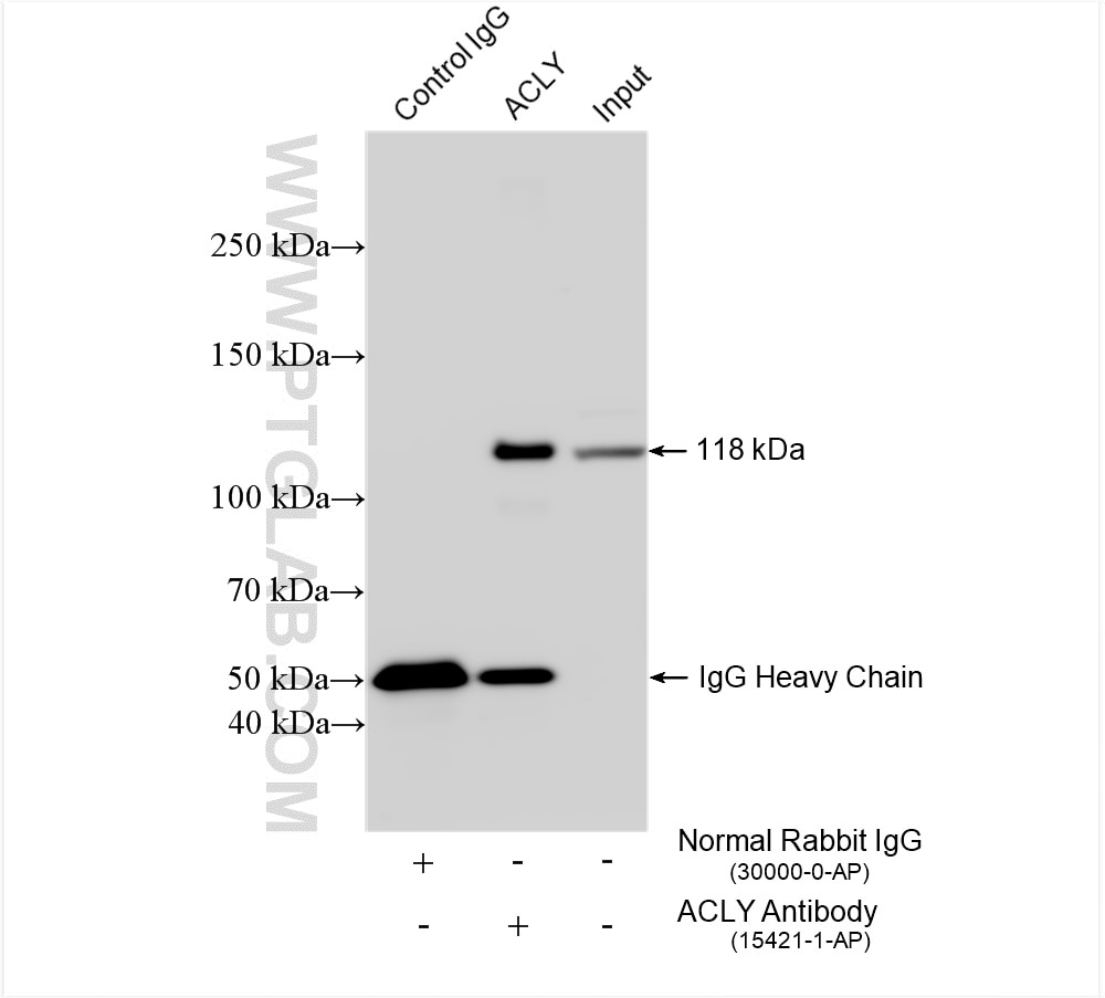 Immunoprecipitation (IP) experiment of HeLa cells using ACLY Polyclonal antibody (15421-1-AP)