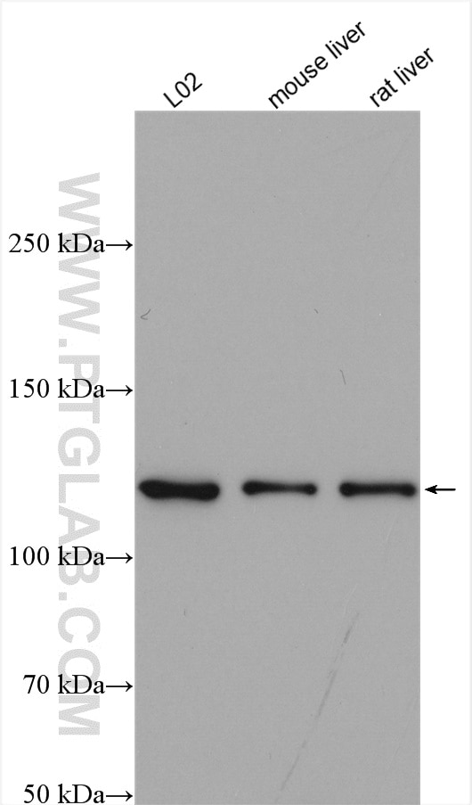 Western Blot (WB) analysis of various lysates using ACLY Polyclonal antibody (15421-1-AP)