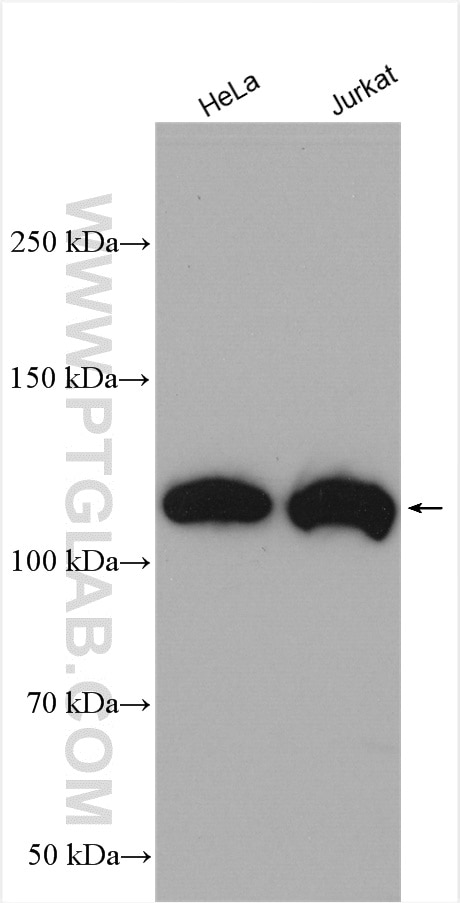 Western Blot (WB) analysis of various lysates using ACLY Polyclonal antibody (15421-1-AP)