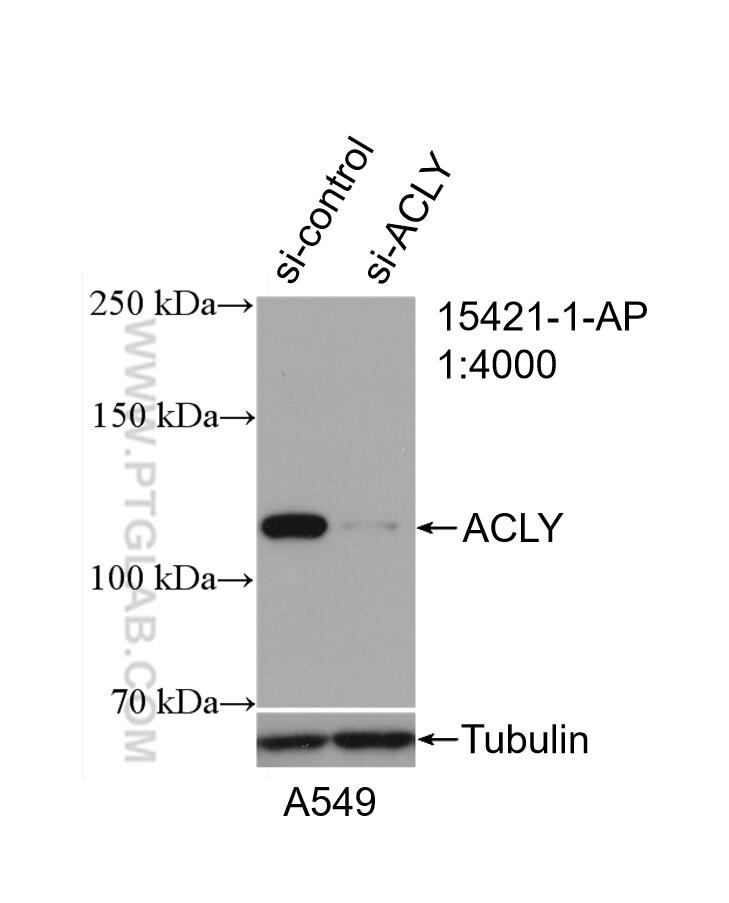 Western Blot (WB) analysis of A549 cells using ACLY Polyclonal antibody (15421-1-AP)