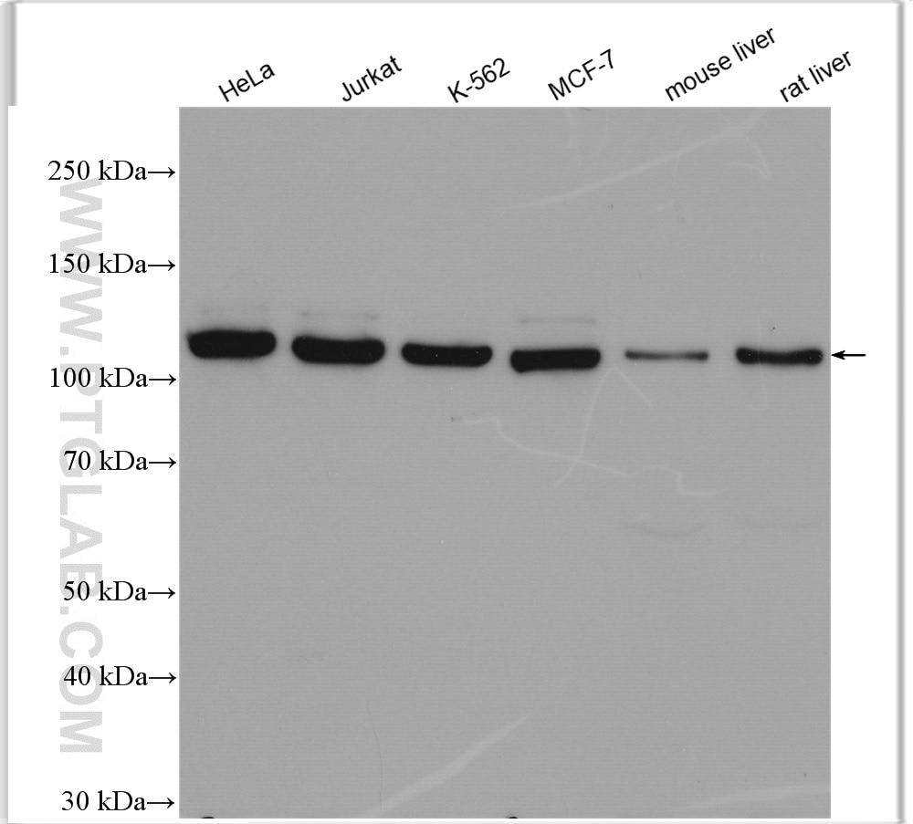 Western Blot (WB) analysis of various lysates using ACLY Polyclonal antibody (15421-1-AP)