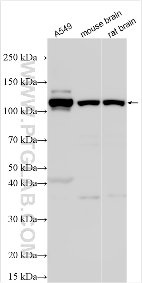 Western Blot (WB) analysis of various lysates using ACLY Polyclonal antibody (15421-1-AP)