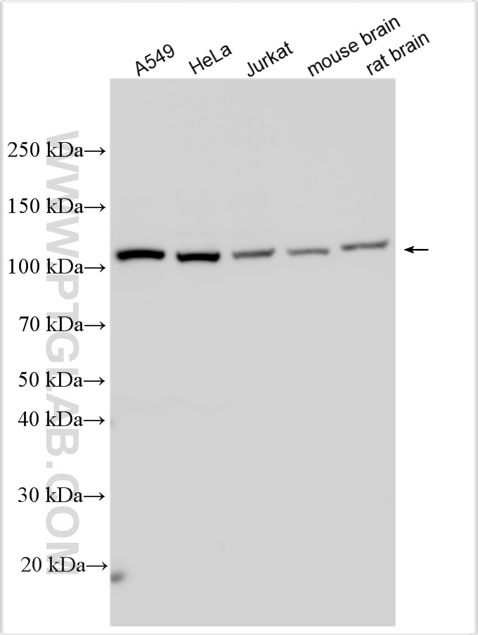 Western Blot (WB) analysis of various lysates using ACLY Polyclonal antibody (15421-1-AP)