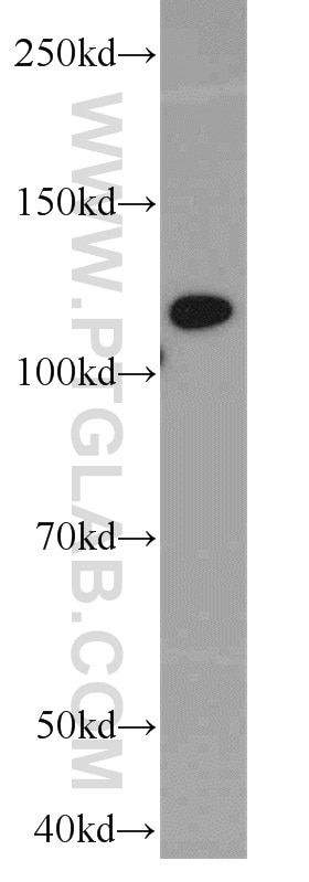 ACLY Polyclonal antibody