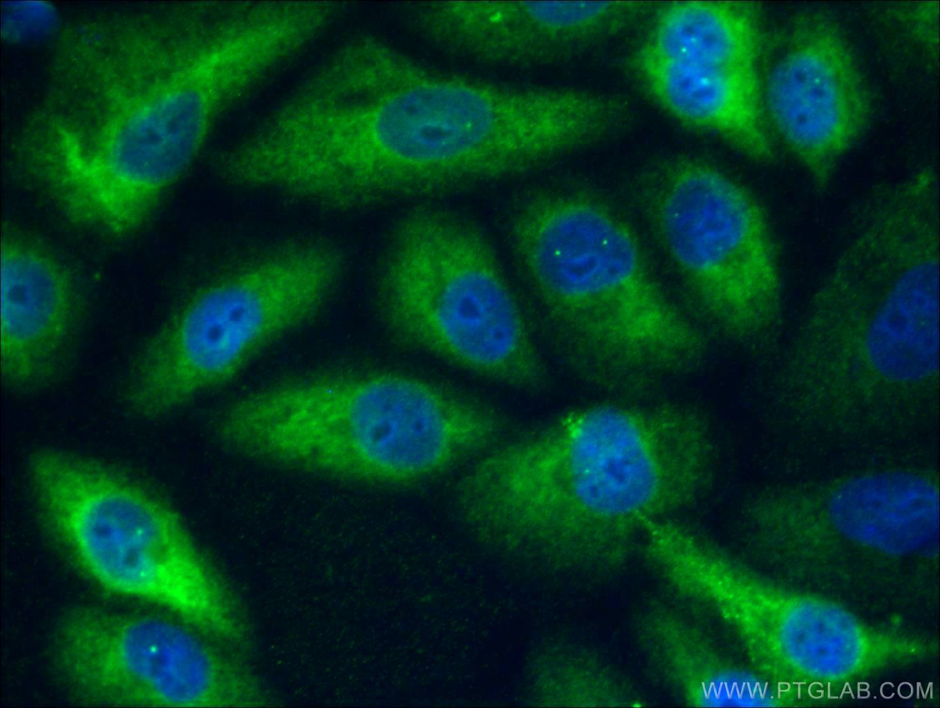 Immunofluorescence (IF) / fluorescent staining of A549 cells using ACLY Monoclonal antibody (67166-1-Ig)