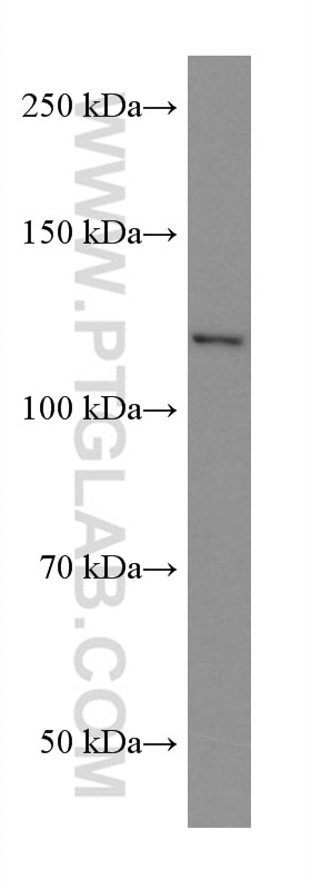 Western Blot (WB) analysis of MCF-7 cells using ACLY Monoclonal antibody (67166-1-Ig)