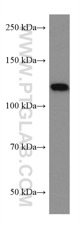 Western Blot (WB) analysis of Jurkat cells using ACLY Monoclonal antibody (67166-1-Ig)