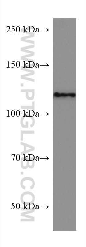 Western Blot (WB) analysis of HSC-T6 cells using ACLY Monoclonal antibody (67166-1-Ig)