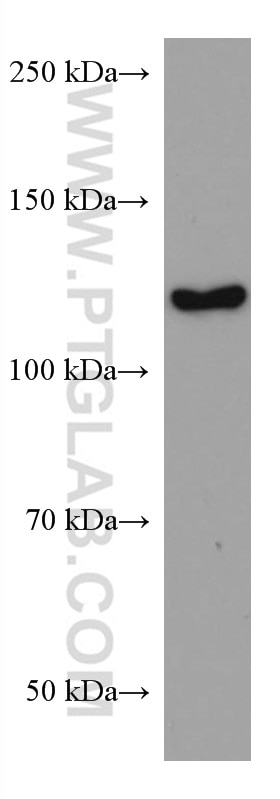 Western Blot (WB) analysis of Jurkat cells using ACLY Monoclonal antibody (67166-1-Ig)