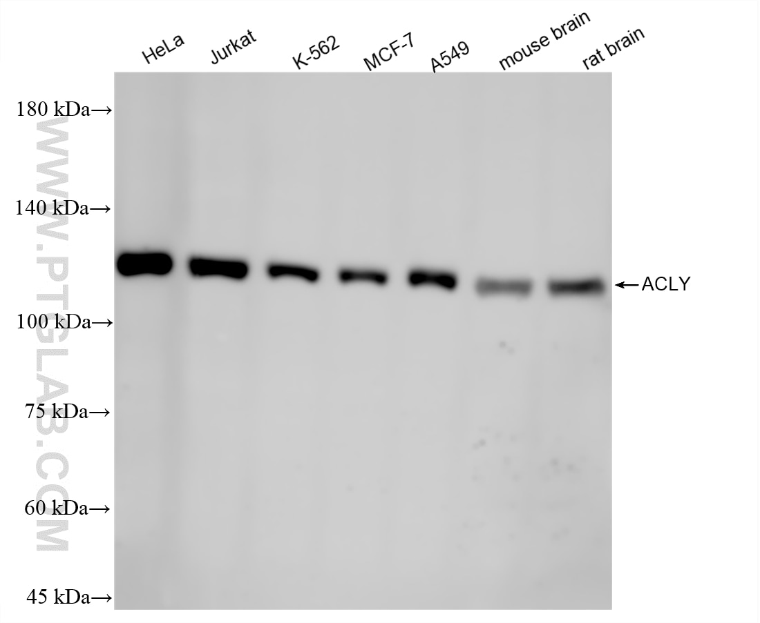 WB analysis using 87231-1-RR (same clone as 87231-1-PBS) Western Blot (WB) analysis of various lysates using ACLY Recombinant monoclonal antibody (87231-1-RR)