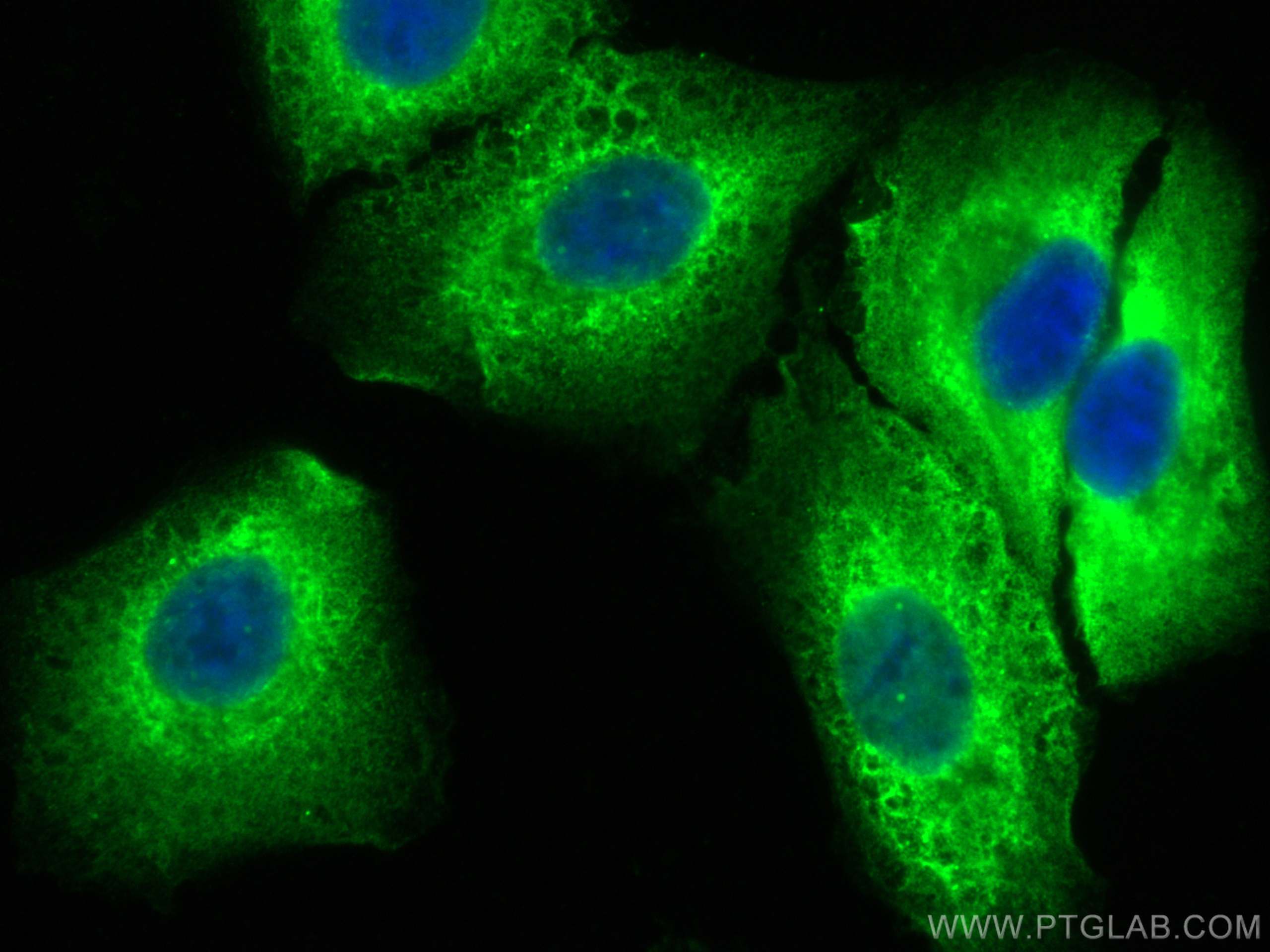 Immunofluorescence (IF) / fluorescent staining of A549 cells using CoraLite® Plus 488-conjugated ACLY Monoclonal anti (CL488-67166)