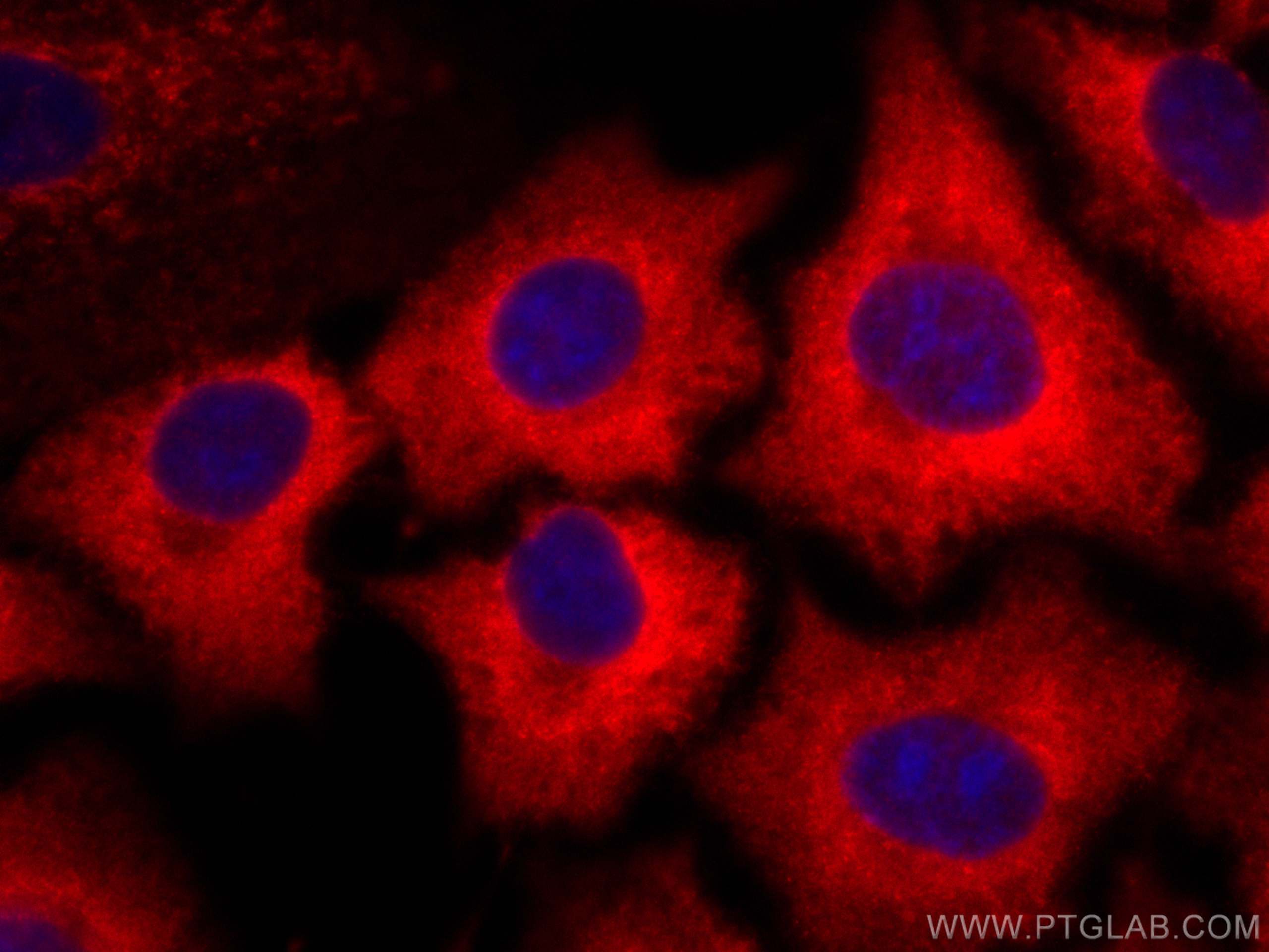 Immunofluorescence (IF) / fluorescent staining of A549 cells using CoraLite®594-conjugated ACLY Monoclonal antibody (CL594-67166)