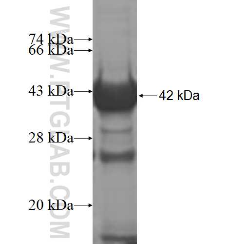 ACLY fusion protein Ag7940 SDS-PAGE