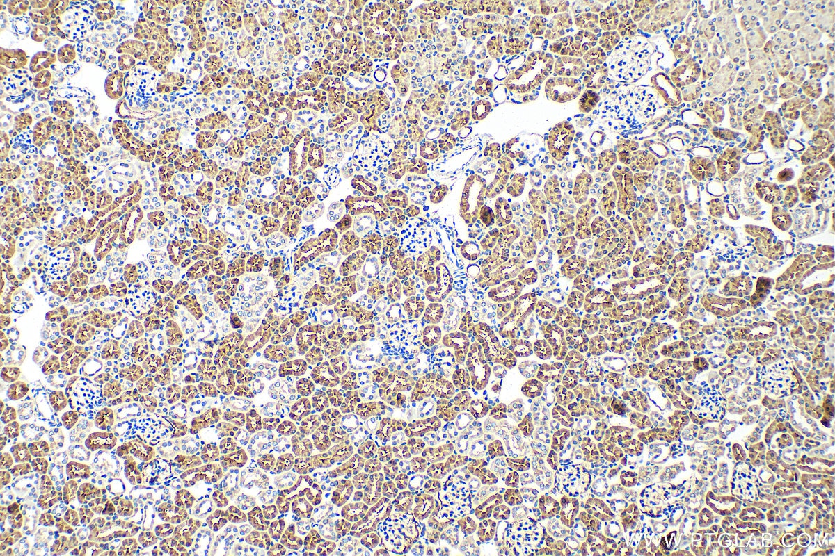 Immunohistochemistry (IHC) staining of mouse kidney tissue using ACMSD Polyclonal antibody (26834-1-AP)