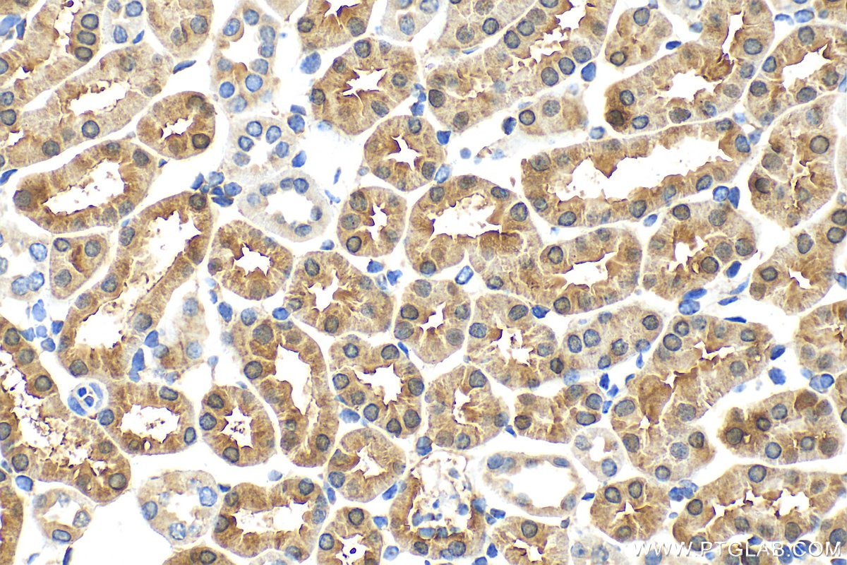 Immunohistochemistry (IHC) staining of mouse kidney tissue using ACMSD Polyclonal antibody (26834-1-AP)