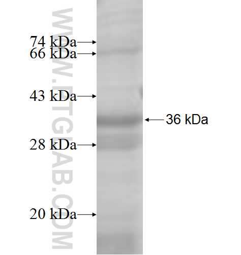ACMSD fusion protein Ag7994 SDS-PAGE