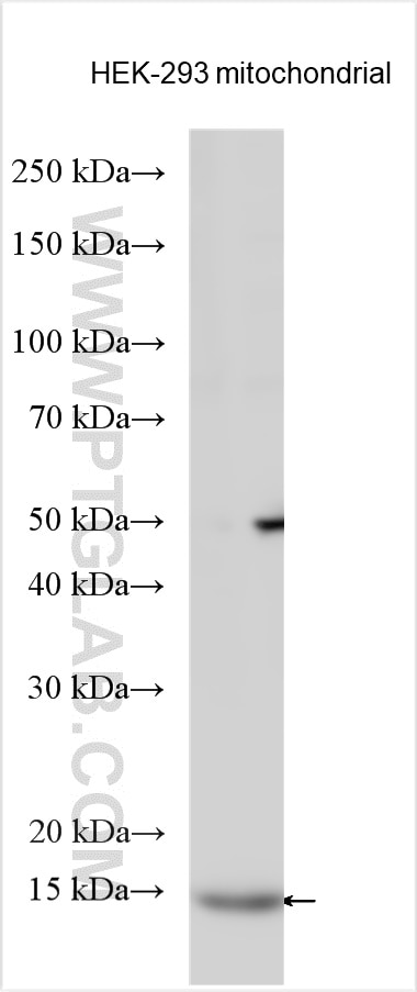 Western Blot (WB) analysis of various lysates using ACN9 Polyclonal antibody (20410-1-AP)