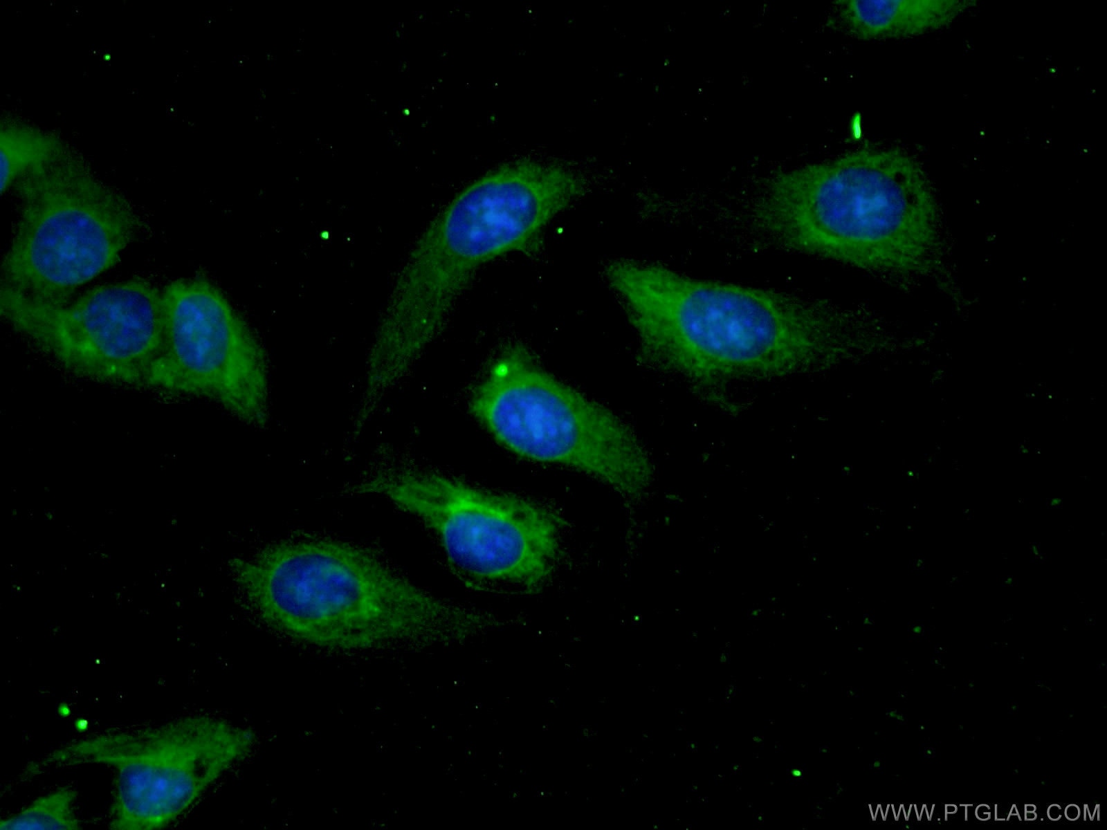 Immunofluorescence (IF) / fluorescent staining of U2OS cells using Aconitase 1 Polyclonal antibody (12406-1-AP)