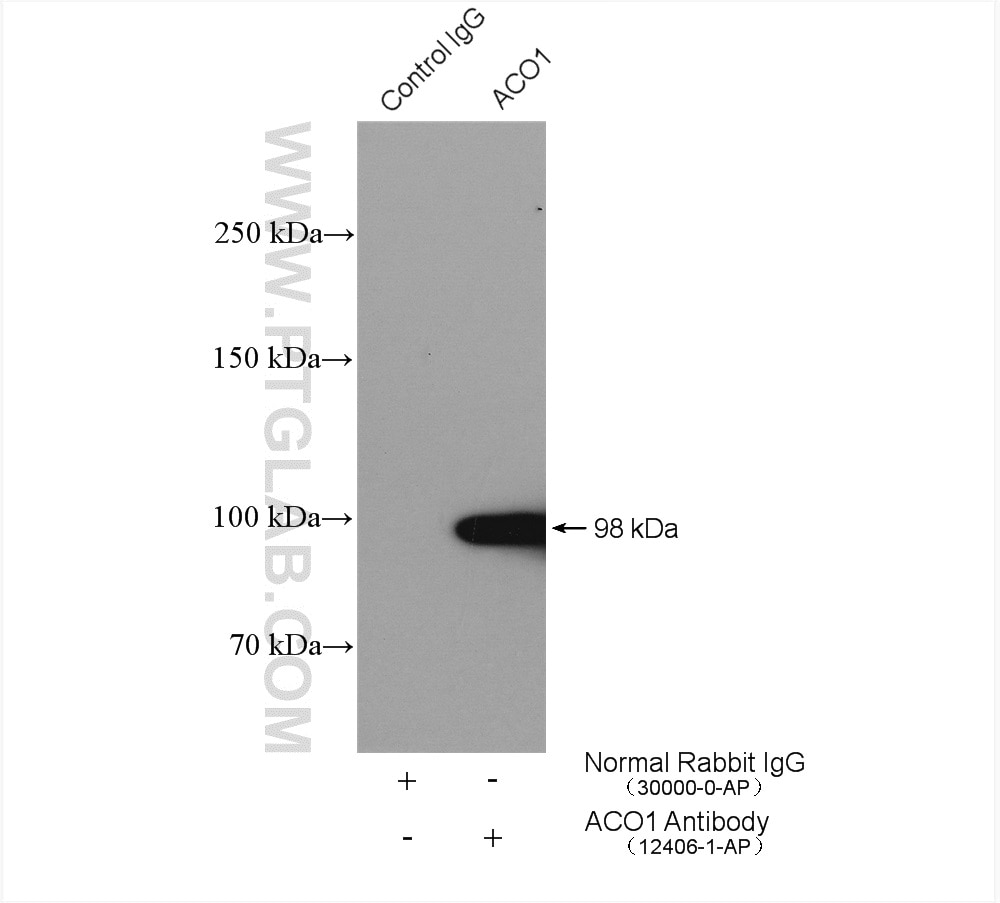 Immunoprecipitation (IP) experiment of mouse liver tissue using Aconitase 1 Polyclonal antibody (12406-1-AP)
