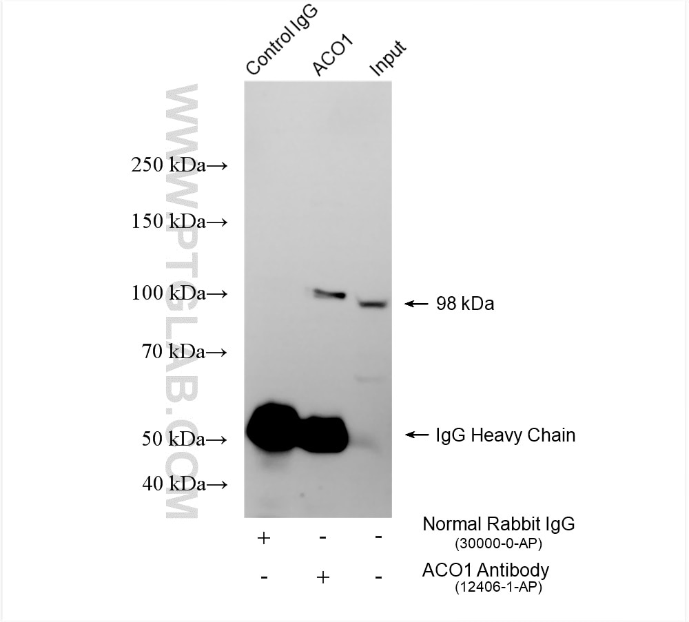 Immunoprecipitation (IP) experiment of HepG2 cells using Aconitase 1 Polyclonal antibody (12406-1-AP)