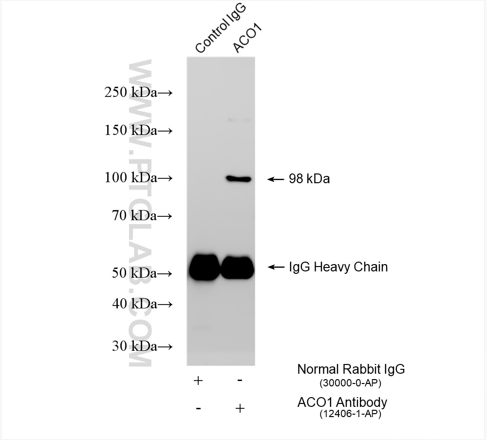 Immunoprecipitation (IP) experiment of HepG2 cells using Aconitase 1 Polyclonal antibody (12406-1-AP)