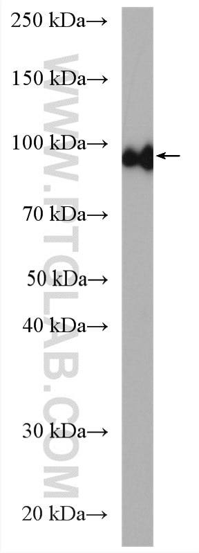 Western Blot (WB) analysis of mouse kidney tissue using Aconitase 1 Polyclonal antibody (12406-1-AP)