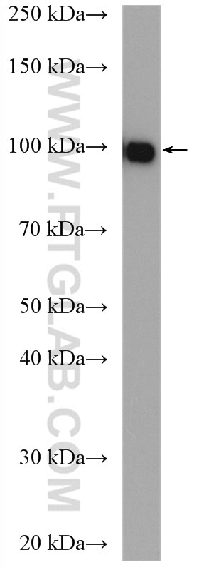 Western Blot (WB) analysis of mouse liver tissue using Aconitase 1 Polyclonal antibody (12406-1-AP)