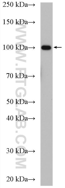 Western Blot (WB) analysis of HepG2 cells using Aconitase 1 Polyclonal antibody (12406-1-AP)