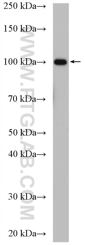 Western Blot (WB) analysis of HepG2 cells using Aconitase 1 Polyclonal antibody (12406-1-AP)