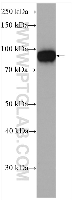 Western Blot (WB) analysis of mouse kidney tissue using Aconitase 1 Polyclonal antibody (12406-1-AP)