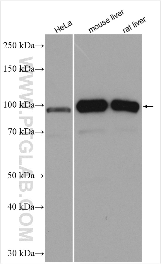 Western Blot (WB) analysis of various lysates using Aconitase 1 Polyclonal antibody (12406-1-AP)