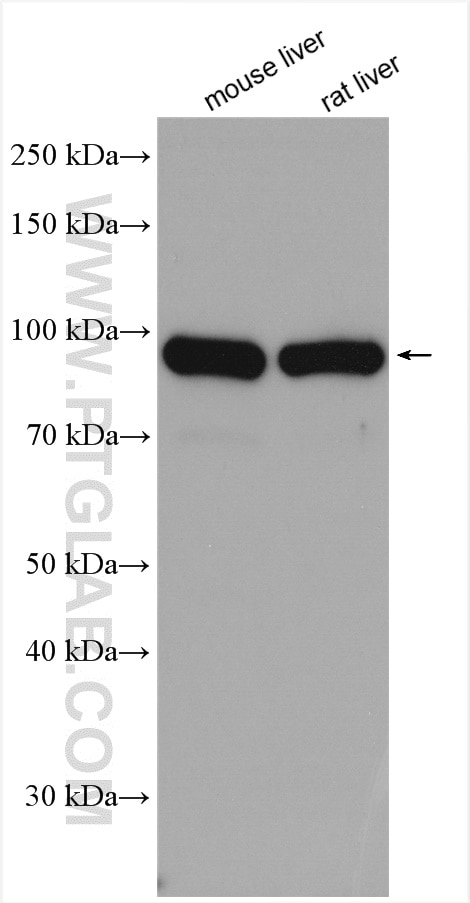 Western Blot (WB) analysis of various lysates using Aconitase 1 Polyclonal antibody (12406-1-AP)