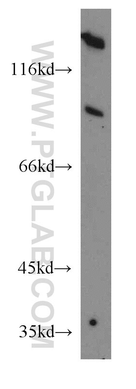 Aconitase 1