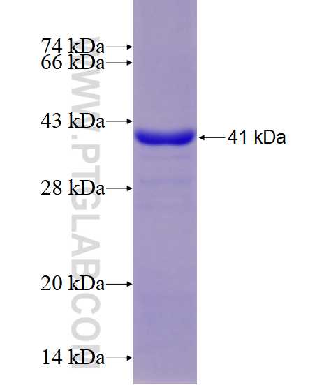 ACO1 fusion protein Ag28562 SDS-PAGE