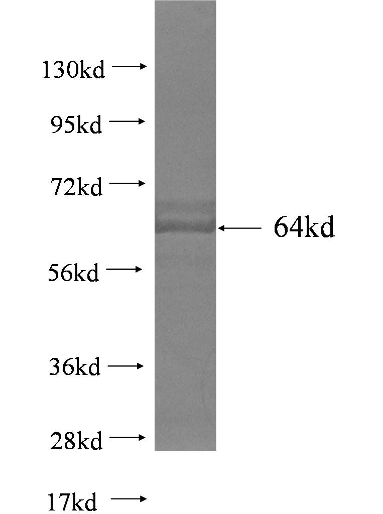 ACO1 fusion protein Ag3083 SDS-PAGE