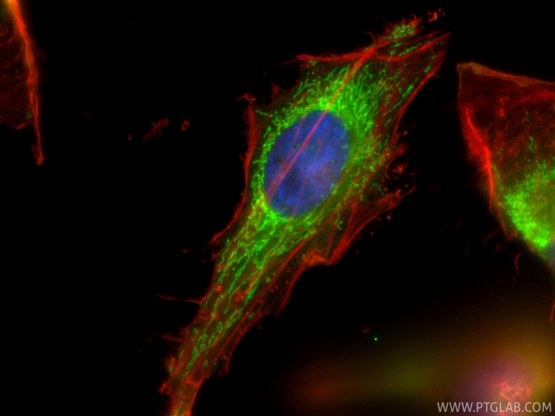 Immunofluorescent analysis of (4% PFA) fixed HeLa cells using Aconitase 2 antibody (11134-1-AP) at dilution of 1:400 and CoraLite®488-Conjugated Goat Anti-Rabbit IgG(H+L) (SA00013-2), CL594-phalloidin (red). Immunofluorescence (IF) / fluorescent staining of HeLa cells using Aconitase 2 Polyclonal antibody (11134-1-AP)