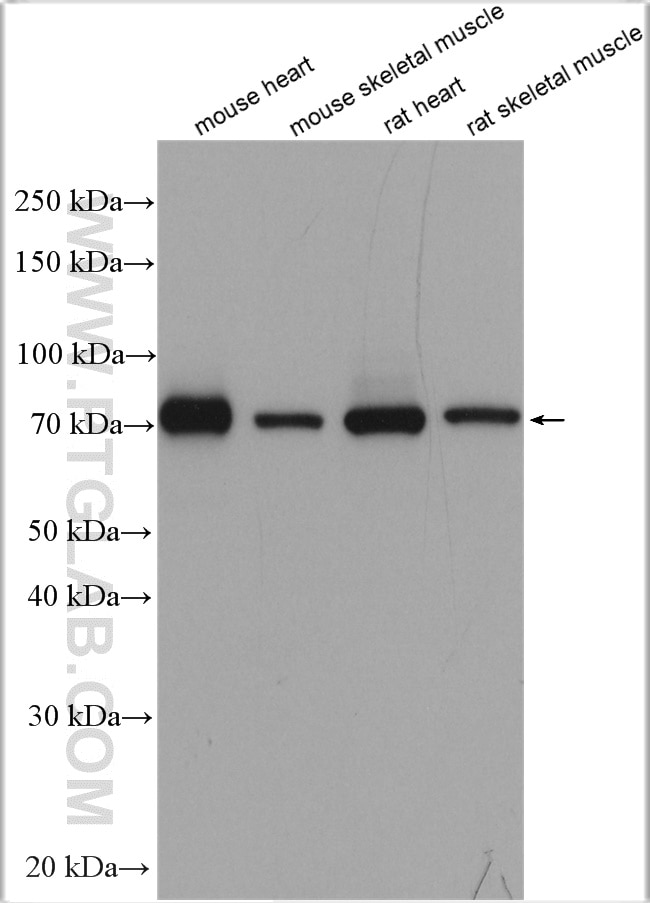 Western Blot (WB) analysis of various lysates using Aconitase 2 Polyclonal antibody (11134-1-AP)