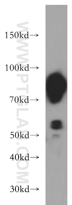 Aconitase 2