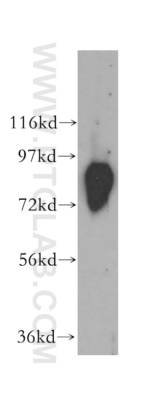 Western Blot (WB) analysis of human liver tissue using Aconitase 2 Polyclonal antibody (11134-1-AP)