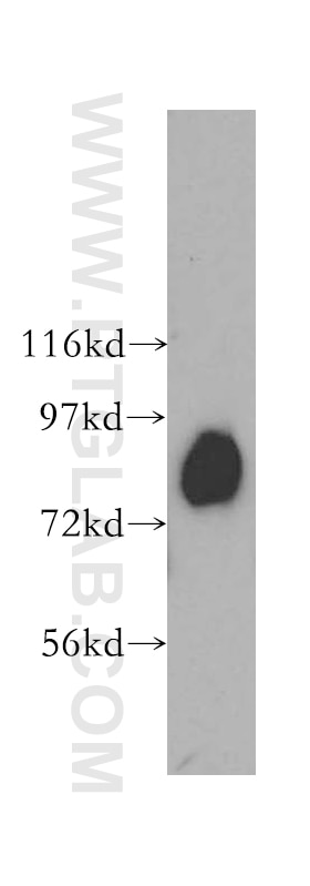 Western Blot (WB) analysis of human skeletal muscle tissue using Aconitase 2 Polyclonal antibody (11134-1-AP)