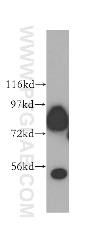 Western Blot (WB) analysis of HeLa cells using Aconitase 2 Polyclonal antibody (11134-1-AP)