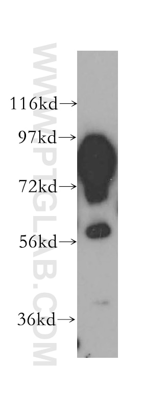 Western Blot (WB) analysis of human heart tissue using Aconitase 2 Polyclonal antibody (11134-1-AP)