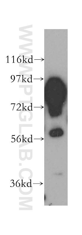 WB analysis of human heart using 11134-1-AP