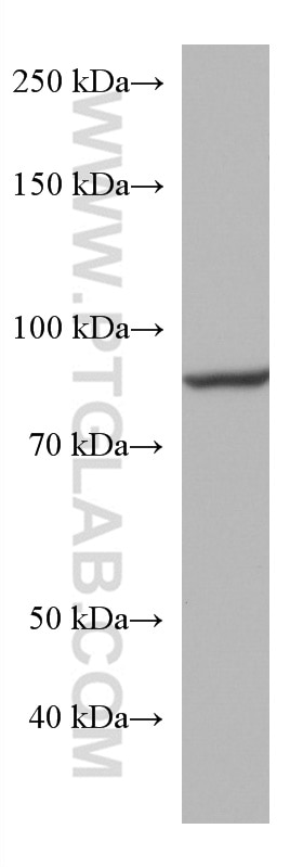 Western Blot (WB) analysis of rat brain tissue using ACO2 Monoclonal antibody (67509-1-Ig)