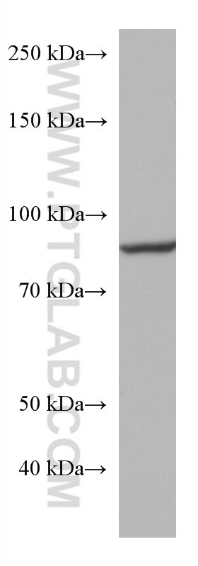 Western Blot (WB) analysis of rat brain tissue using ACO2 Monoclonal antibody (67509-1-Ig)