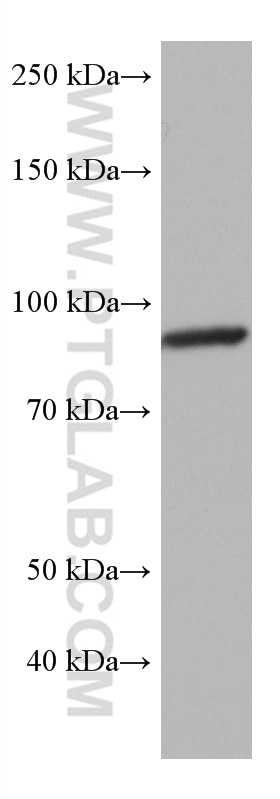 Western Blot (WB) analysis of mouse brain tissue using ACO2 Monoclonal antibody (67509-1-Ig)