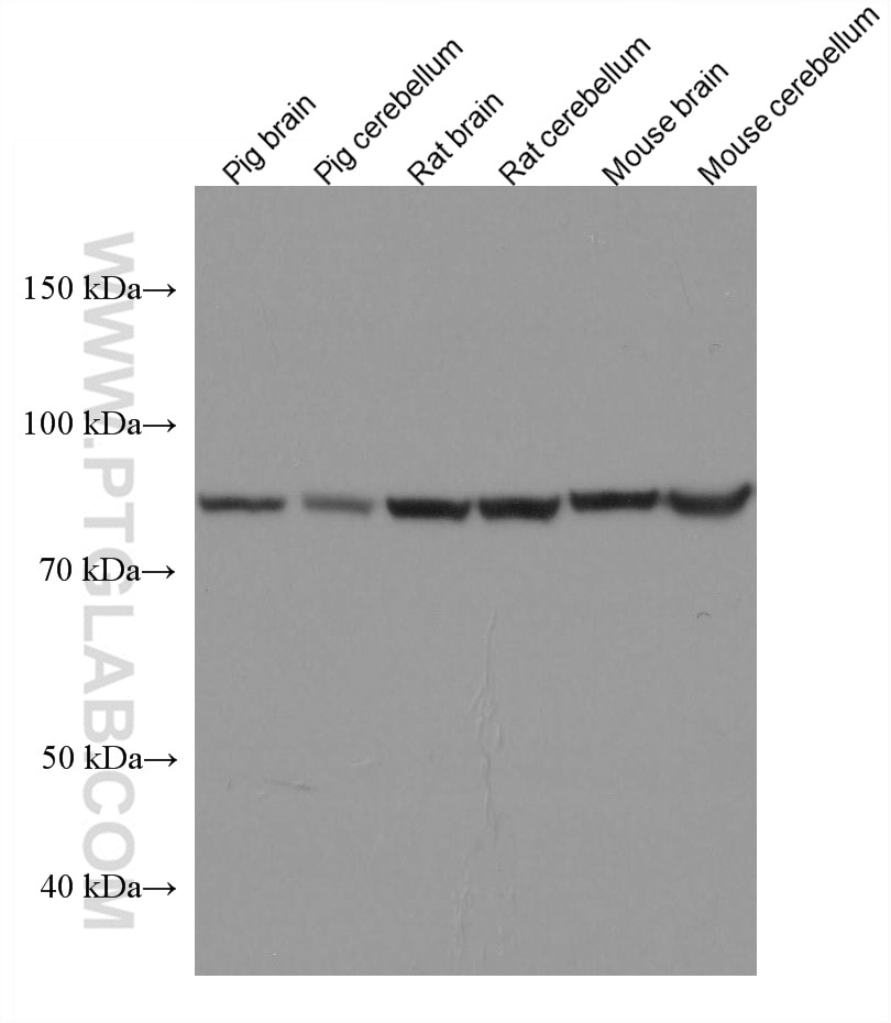 Western Blot (WB) analysis of various lysates using ACO2 Monoclonal antibody (67509-1-Ig)