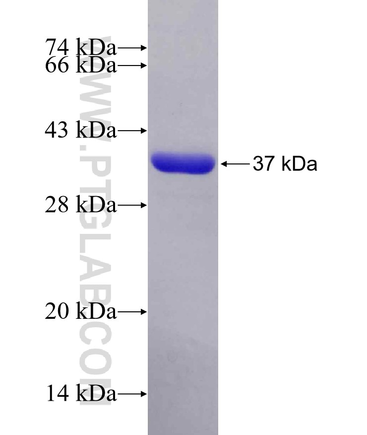ACO2 fusion protein Ag17784 SDS-PAGE